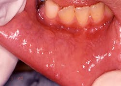 1206rdhcbur 1206rdhcbur