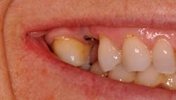 1206rdhfsal10 1206rdhfsal10