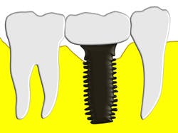 1206rdhfsal6 1206rdhfsal6