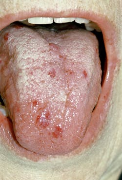 1208rdhcbur2 1208rdhcbur2