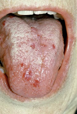 1208rdhcbur2 1208rdhcbur2