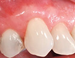 1208rdhfrlgafter6 1208rdhfrlgafter6