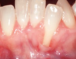 1208rdhfrlgbefore23 1208rdhfrlgbefore23