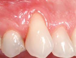 1208rdhfrlgbefore6 1208rdhfrlgbefore6