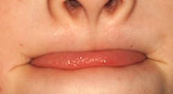 1211rdhcbur3 1211rdhcbur3