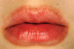 1211rdhcbur4 1211rdhcbur4