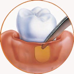 1212rdhmill2a 1212rdhmill2a