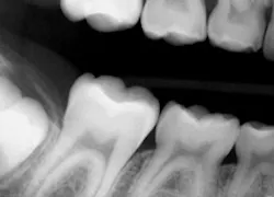 1303rdhcmill01 1303rdhcmill01