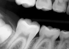 1303rdhcmill01 1303rdhcmill01