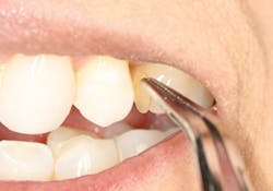 1305rdhcmill03 1305rdhcmill03