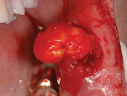 1306rdhcbur03 1306rdhcbur03