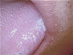 Figure 2: Steven Chew, DDS, Pleasanton, CA, and Carol Perkins, RDH. Figure 2: Steven Chew, DDS, Pleasanton, CA, and Carol Perkins, RDH.