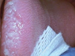 Figure 1: Steven Chew, DDS, Pleasanton, CA, and Carol Perkins, RDH. Figure 1: Steven Chew, DDS, Pleasanton, CA, and Carol Perkins, RDH.