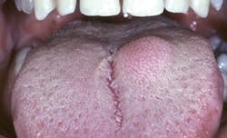 1309rdhcbur01 1309rdhcbur01