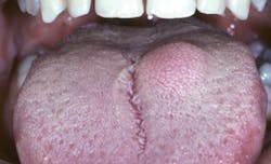 1309rdhcbur01 1309rdhcbur01