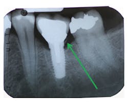 1312csli01 1312csli01