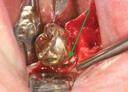 1312csli02 1312csli02