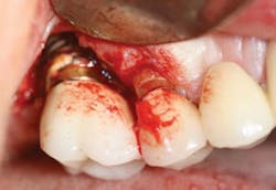 1312csli03 1312csli03