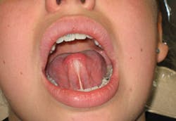 1312rdh Cbur01 1312rdh Cbur01