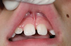 1312rdh Cbur03 1312rdh Cbur03