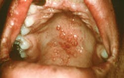 1401rdhcbur02 1401rdhcbur02