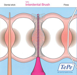 The effectiveness of interdental brushes | Registered Dental Hygienist (RDH) Magazine The effectiveness of interdental brushes | Registered Dental Hygienist (RDH) Magazine