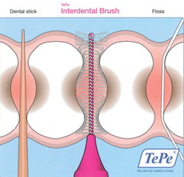 The effectiveness of interdental brushes Registered Dental Hygienist