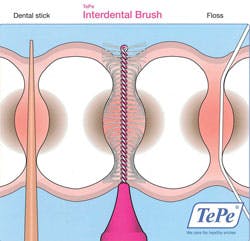 1401rdhfieb Interdental Illustration 1401rdhfieb Interdental Illustration
