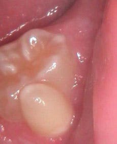 1404rdhcbur Figure2 1404rdhcbur Figure2