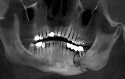 1407rdhcsli02 1407rdhcsli02