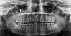 1411rdhcbur01 1411rdhcbur01