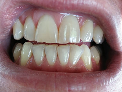 1501rdhcgla As Smart Object 1