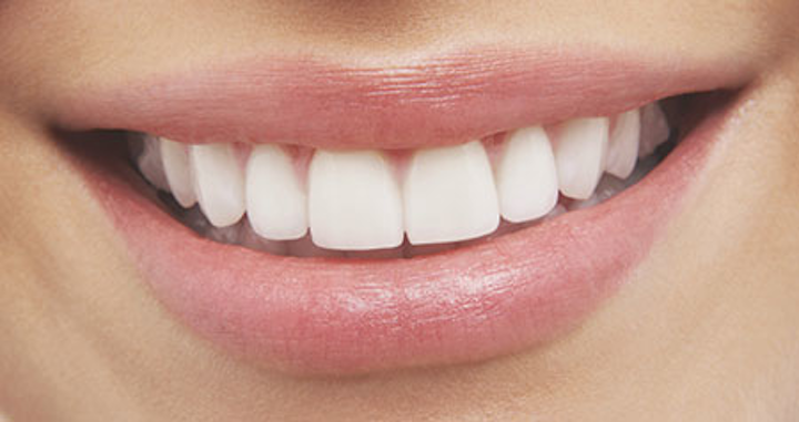 White teeth, the professional way | Registered Dental Hygienist (RDH) Magazine