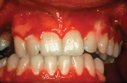 1503rdhcburfigure1 1503rdhcburfigure1