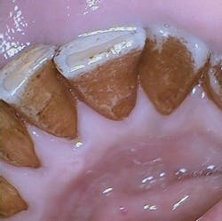 1504rdhcbur Stain 1 1504rdhcbur Stain 1