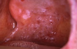 1505rdhcbur Lpp 1505rdhcbur Lpp