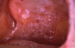 1505rdhcbur Lpp 1505rdhcbur Lpp