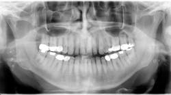 1506rdhcburfigure1 1506rdhcburfigure1