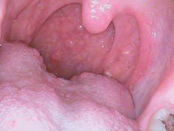 1506rdhcburfigure2 1506rdhcburfigure2