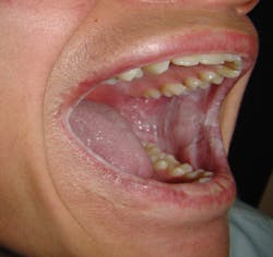 1510rdhcbur02 1510rdhcbur02