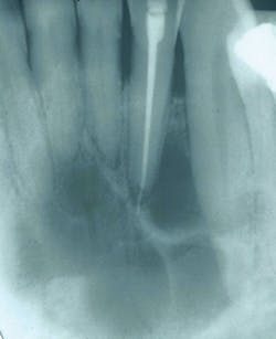 1512rdhcbur P01 1512rdhcbur P01