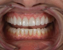 1512rdhfets P01 1512rdhfets P01