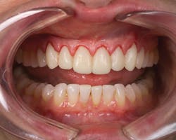 1512rdhfets P03 1512rdhfets P03