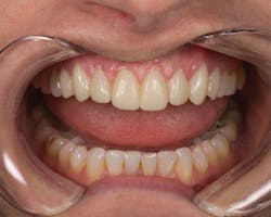 1512rdhfets P04 1512rdhfets P04