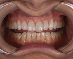 1512rdhfets P05 1512rdhfets P05