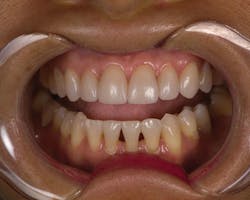 1512rdhfets P07 1512rdhfets P07