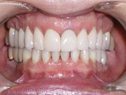 5yearfollowup1 5yearfollowup1