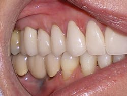 5yearfollowup4 5yearfollowup4