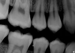 1enamel Pearl 1enamel Pearl