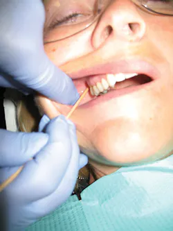 Anesthesia during perio: Maxillary injections useful for adult ...